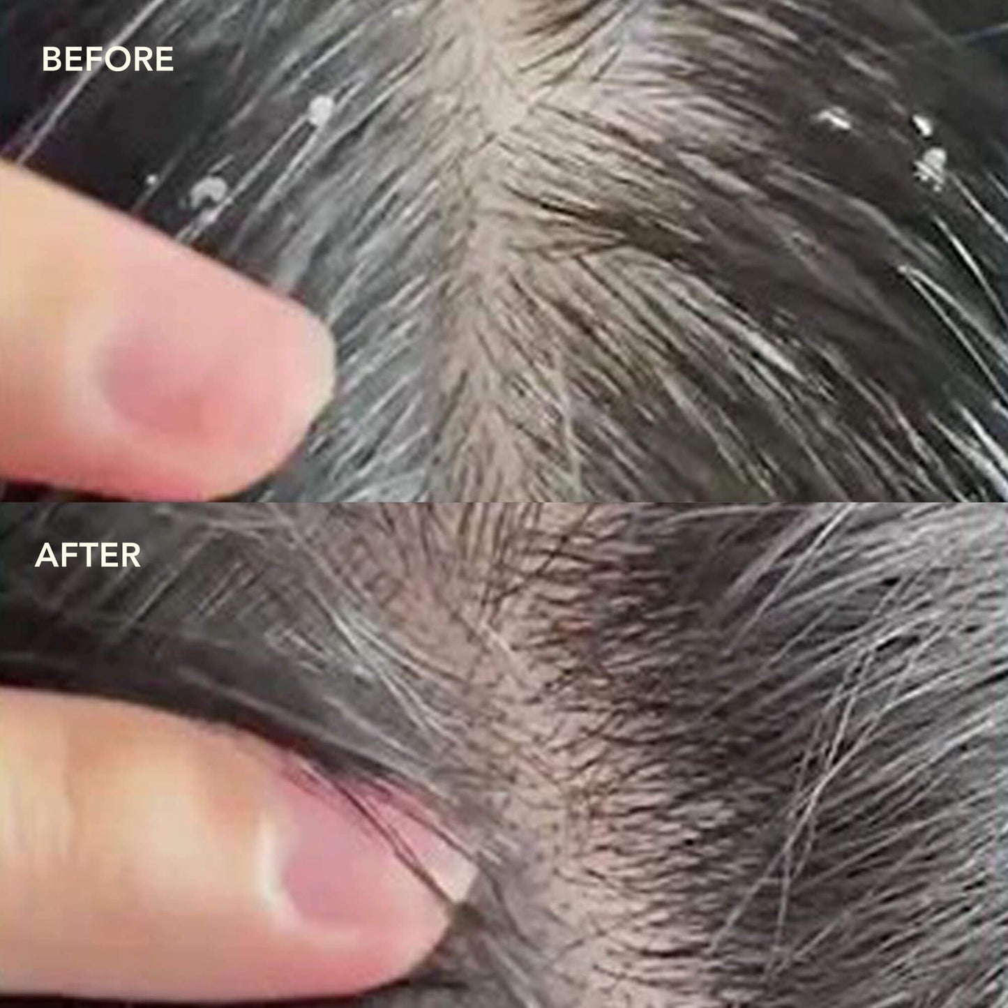 NEEM + SALICYLIC ACID Exfoliating Scalp Serum (Wholesale)