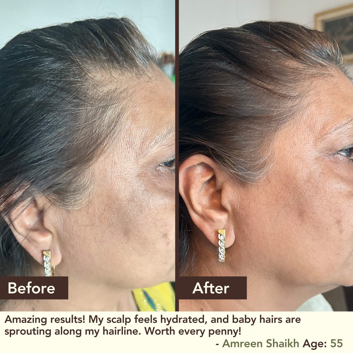 SHIKAKAI + BHRINGRAJ Hair Growth Scalp Serum (Wholesale)
