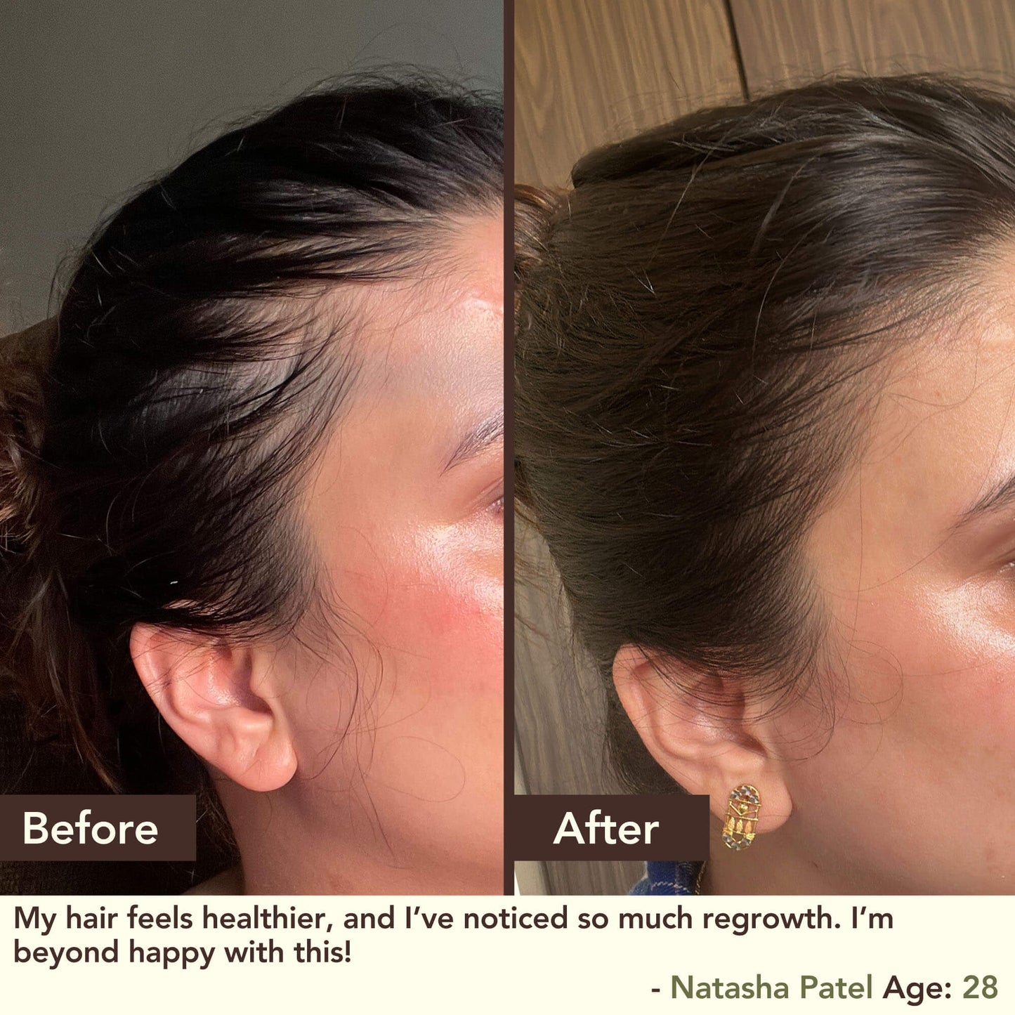 SHIKAKAI + BHRINGRAJ Hair Growth Serum