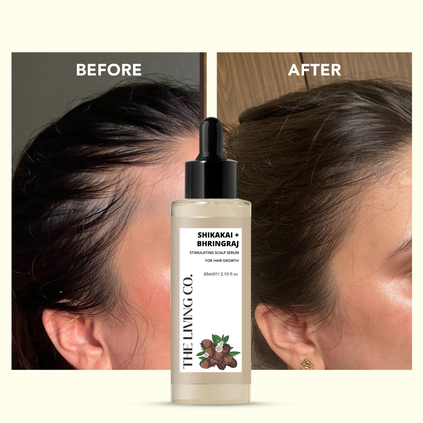 SHIKAKAI + BHRINGRAJ Hair Growth Serum