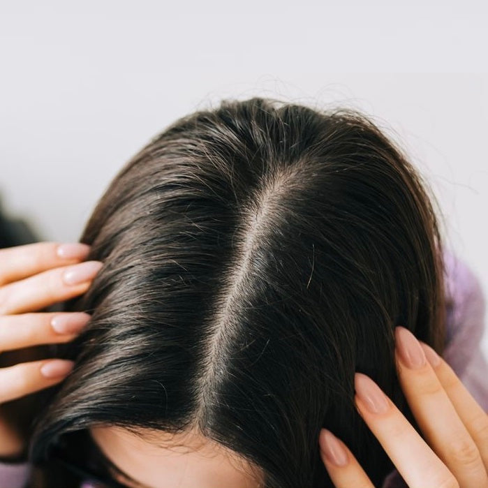 OILY SCALP