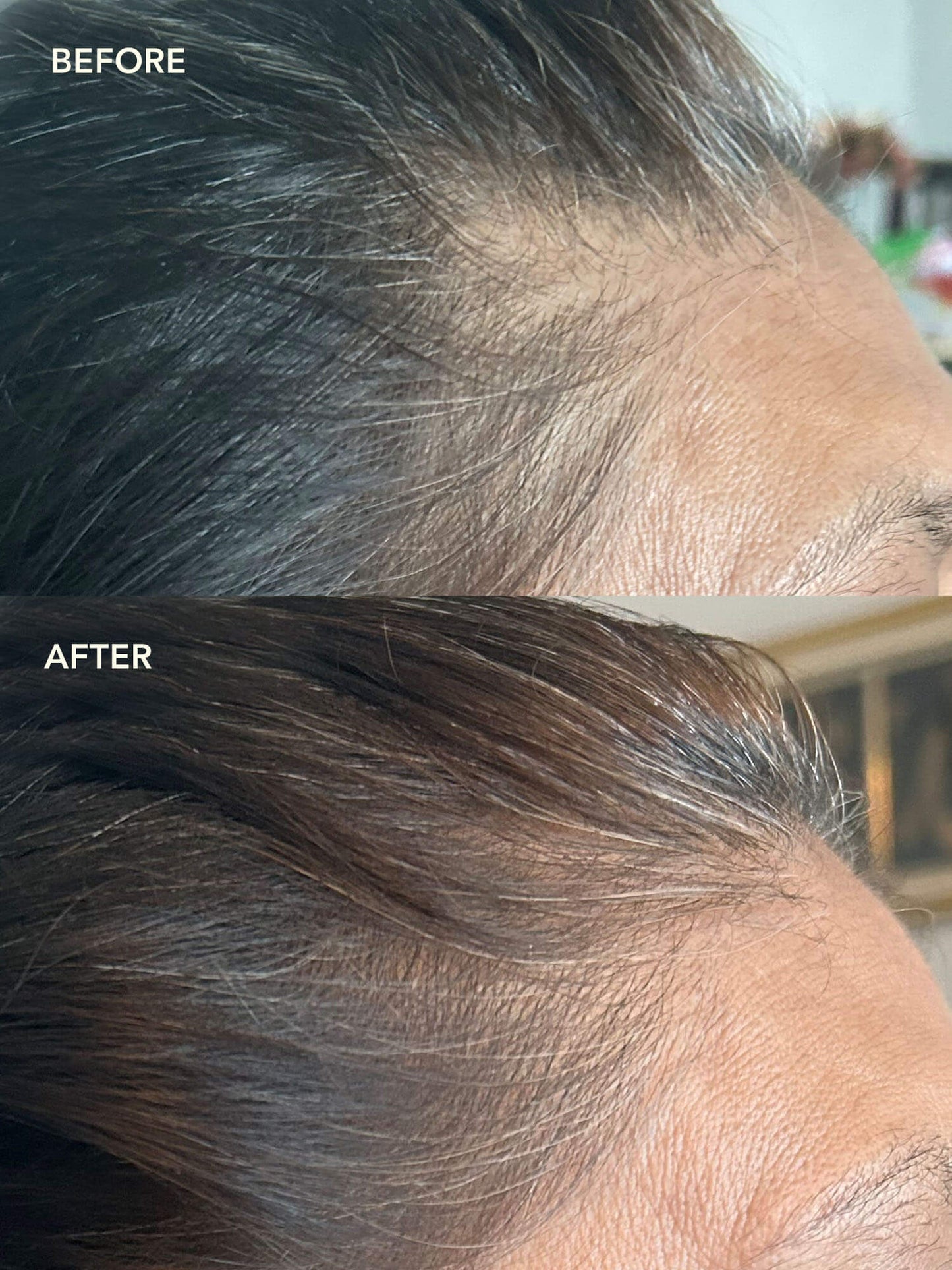 SHIKAKAI + BHRINGRAJ Stimulating Scalp Serum for Hair Growth