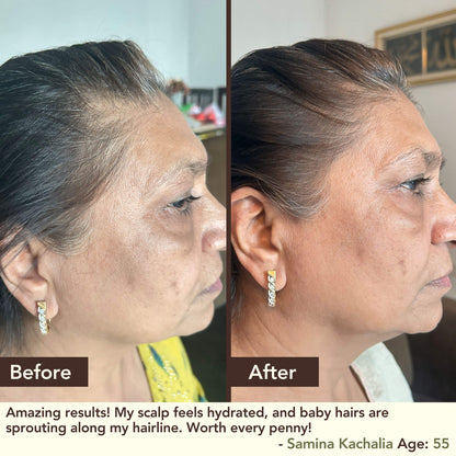 BHRINGRAJ Hair Growth Serum