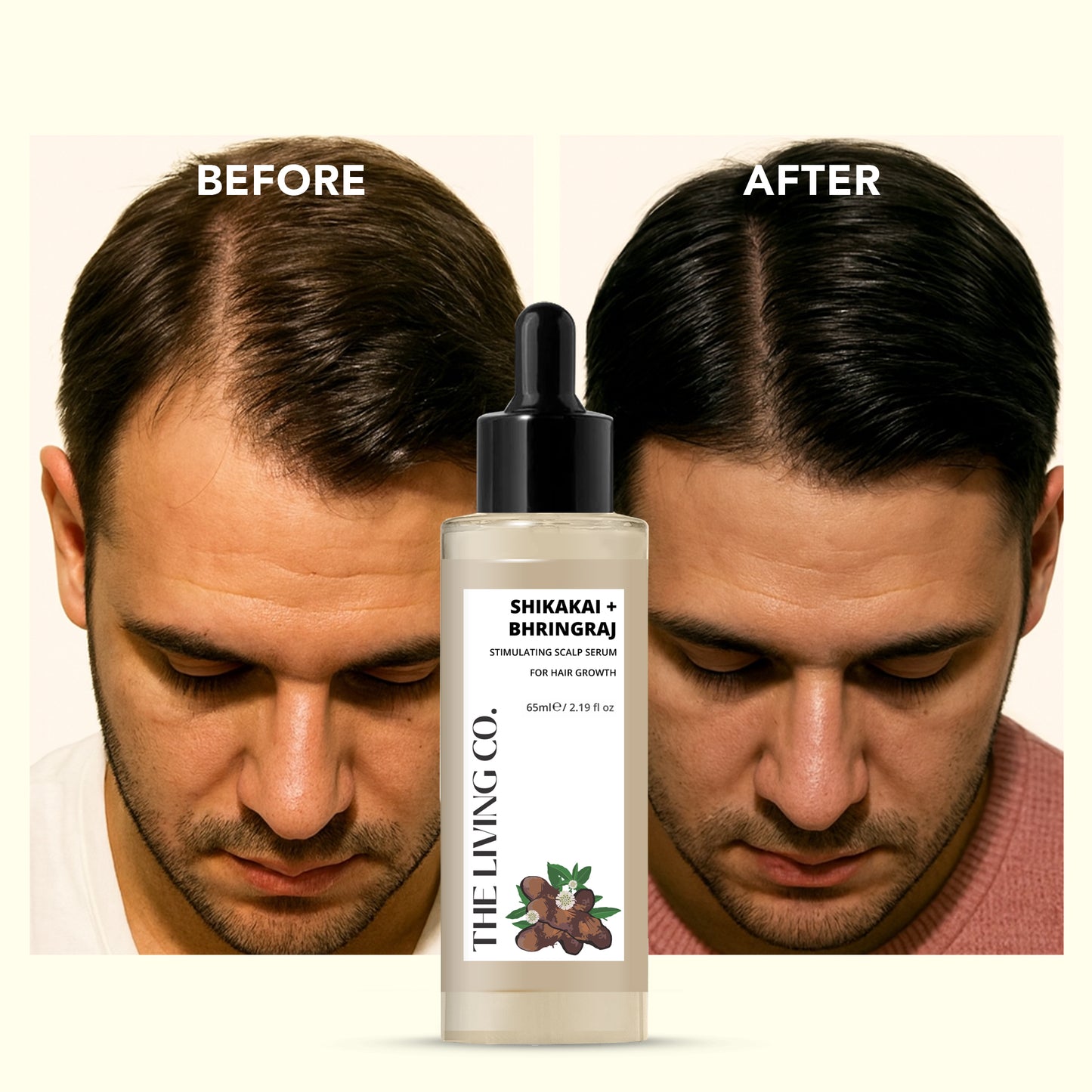 SHIKAKAI + BHRINGRAJ Hair Growth Serum for MEN