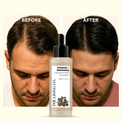 SHIKAKAI + BHRINGRAJ Hair Growth Serum for MEN